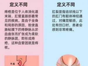 拔萝卜痛又降黄 91 发出——专业治疗痔疮的优质产品