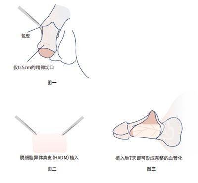 自然增大变粗的方法，让你轻松找回自信