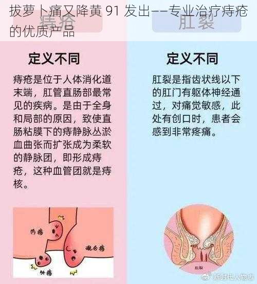 拔萝卜痛又降黄 91 发出——专业治疗痔疮的优质产品