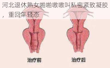 河北退休熟女啪啪嗷嗷叫私密紧致凝胶，重回年轻态